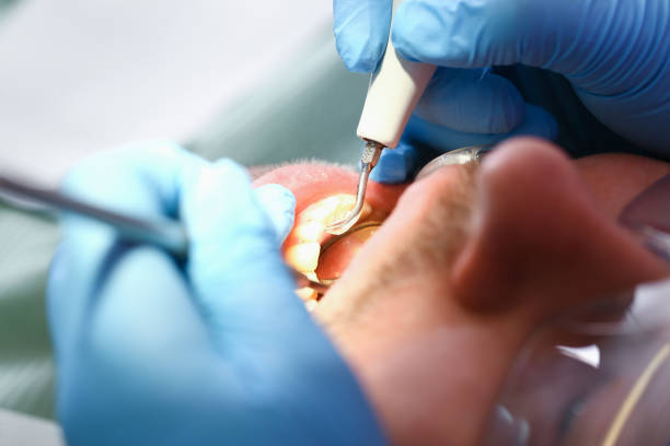 Best Pediatric Emergency Dentist in Long Beach, MS
